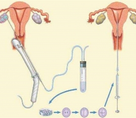 35岁女性备孕请做好以下检查，“健康南通代生宝宝”跑不远